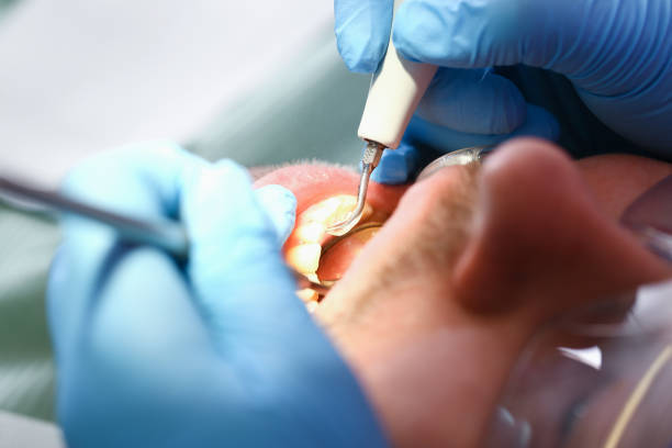 Best Emergency Broken Tooth Repair in Mechanicstown, NY