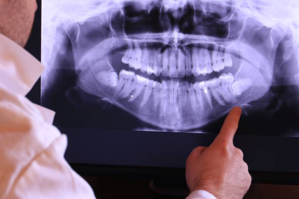 Best Walk-In Emergency Dentist in Mechanicstown, NY