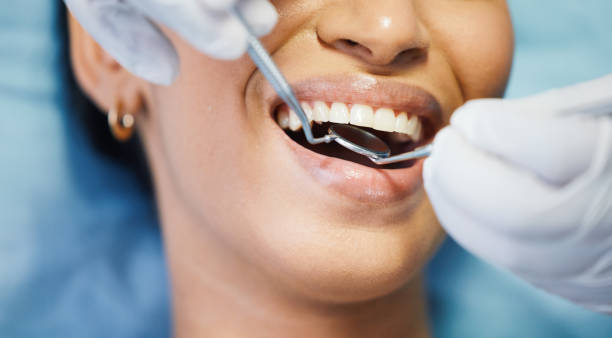 Best Pediatric Emergency Dentist in Mechanicstown, NY