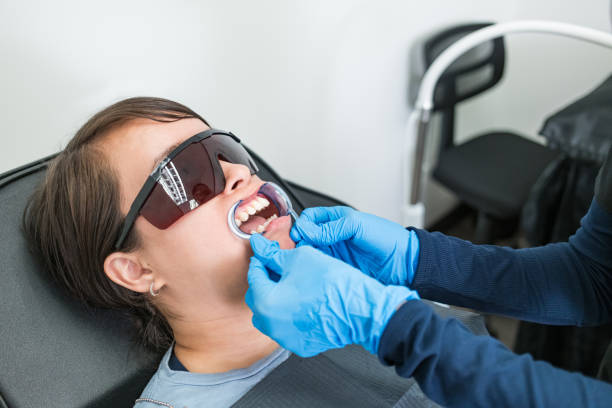 Best Emergency Wisdom Teeth Removal in Mechanicstown, NY